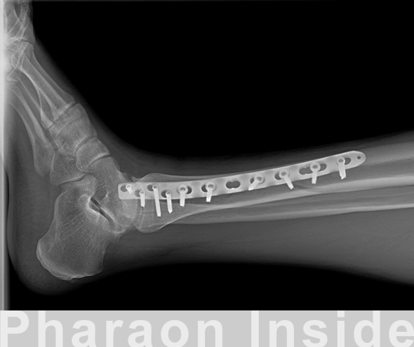 pharaon inside